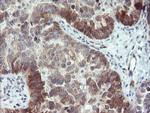 TBCC Antibody in Immunohistochemistry (Paraffin) (IHC (P))