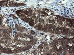 TBCC Antibody in Immunohistochemistry (Paraffin) (IHC (P))