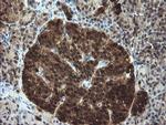 TBCC Antibody in Immunohistochemistry (Paraffin) (IHC (P))