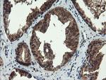 TBCC Antibody in Immunohistochemistry (Paraffin) (IHC (P))