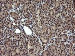 TBCC Antibody in Immunohistochemistry (Paraffin) (IHC (P))