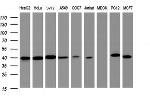 TBCC Antibody in Western Blot (WB)