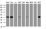 TBCC Antibody in Western Blot (WB)