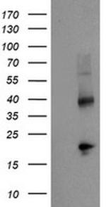 TBCC Antibody in Western Blot (WB)