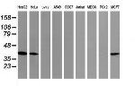 TBCC Antibody in Western Blot (WB)