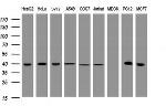 TBCC Antibody in Western Blot (WB)