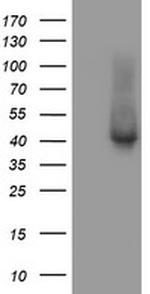 TBCC Antibody in Western Blot (WB)