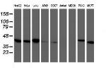 TBCC Antibody in Western Blot (WB)