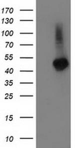 TBCEL Antibody in Western Blot (WB)