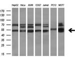 TBCEL Antibody in Western Blot (WB)