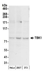 TBK1 Antibody in Western Blot (WB)