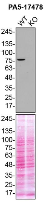 TBK1 Antibody in Western Blot (WB)