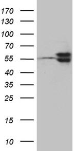 TBL1XR1 Antibody in Western Blot (WB)