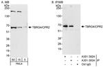 TBRG4/CPR2 Antibody in Western Blot (WB)