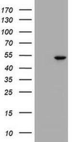 TBX19 (Tpit) Antibody in Western Blot (WB)