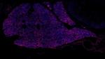 TBX3 Antibody in Immunohistochemistry (Paraffin) (IHC (P))