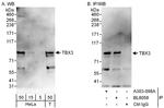 TBX3 Antibody in Western Blot (WB)