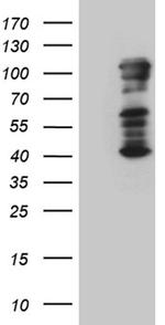 TBX3 Antibody in Western Blot (WB)