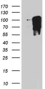 TBX3 Antibody in Western Blot (WB)