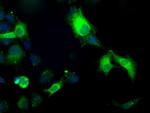 TBXAS Antibody in Immunocytochemistry (ICC/IF)