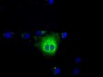 TBXAS Antibody in Immunocytochemistry (ICC/IF)