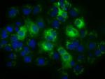 TBXAS Antibody in Immunocytochemistry (ICC/IF)