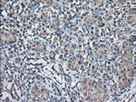 TBXAS Antibody in Immunohistochemistry (Paraffin) (IHC (P))