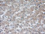 TBXAS Antibody in Immunohistochemistry (Paraffin) (IHC (P))