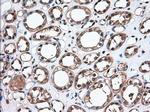 TBXAS Antibody in Immunohistochemistry (Paraffin) (IHC (P))