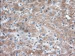 TBXAS Antibody in Immunohistochemistry (Paraffin) (IHC (P))