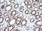 TBXAS Antibody in Immunohistochemistry (Paraffin) (IHC (P))