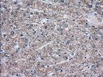 TBXAS Antibody in Immunohistochemistry (Paraffin) (IHC (P))