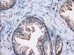 TBXAS Antibody in Immunohistochemistry (Paraffin) (IHC (P))