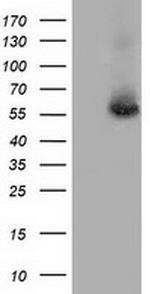 TBXAS Antibody in Western Blot (WB)