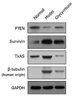 TBXAS Antibody in Western Blot (WB)