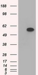 TBXAS Antibody in Western Blot (WB)