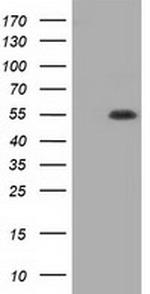 TBXAS Antibody in Western Blot (WB)