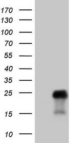 TCAP Antibody in Western Blot (WB)