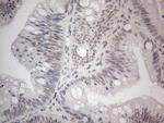 TCEAL1 Antibody in Immunohistochemistry (Paraffin) (IHC (P))