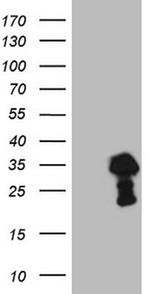 TCEAL1 Antibody in Western Blot (WB)