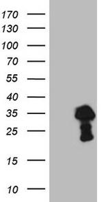 TCEAL1 Antibody in Western Blot (WB)