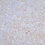 TCEB1 Antibody in Immunohistochemistry (IHC)