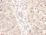 TCEB2 Antibody in Immunohistochemistry (IHC)