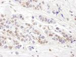 TCEB2 Antibody in Immunohistochemistry (IHC)