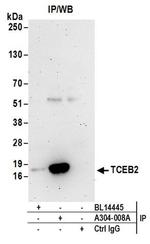 TCEB2 Antibody in Western Blot (WB)