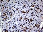 TCF12 Antibody in Immunohistochemistry (Paraffin) (IHC (P))