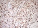 TCP10 Antibody in Immunohistochemistry (Paraffin) (IHC (P))