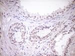 TCP10 Antibody in Immunohistochemistry (Paraffin) (IHC (P))