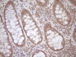 TCP10 Antibody in Immunohistochemistry (Paraffin) (IHC (P))