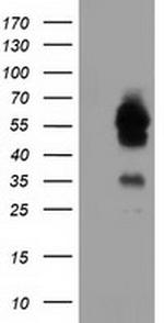 TCP11L2 Antibody in Western Blot (WB)